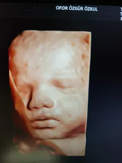 Op. Dr. Özgür Özkul profilinde yer alan galeri fotoğrafı.