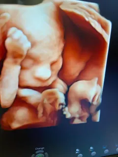 Op. Dr. Emine Suat profilinde yer alan galeri fotoğrafı.