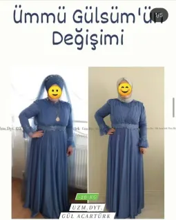 Dyt. Gül Acartürk profilinde yer alan galeri fotoğrafı.