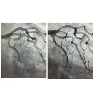 Uzm. Dr. Z.Afşin Çulhaoğlu profilinde yer alan galeri fotoğrafı.