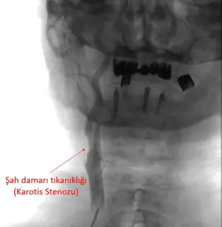 Doç. Dr. Fatih Yakar profilinde yer alan galeri fotoğrafı.
