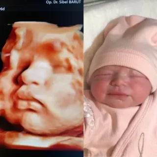 Op. Dr. Sibel Barut profilinde yer alan galeri fotoğrafı.