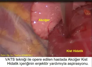 Doç. Dr. Tayfun Kermenli profilinde yer alan galeri fotoğrafı.
