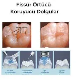 Uzm. Dt. Ceren Güven Özşahin profilinde yer alan galeri fotoğrafı.