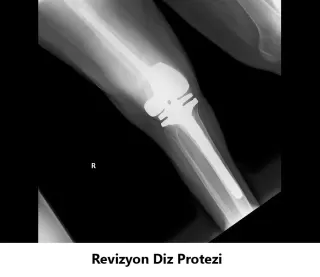 Op. Dr. Javid M. Azarabadı profilinde yer alan galeri fotoğrafı.