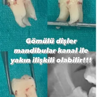 Doç. Dr. Hasan Onur Şimşek profilinde yer alan galeri fotoğrafı.