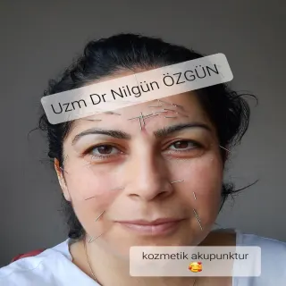 Uzm. Dr. Nilgün Özgün profilinde yer alan galeri fotoğrafı.