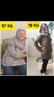 Dyt. Merve Ertem İbiş profilinde yer alan galeri fotoğrafı.