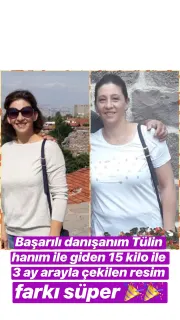 Dyt. Aybüke Subaşıoğlu Yeşilyurt profilinde yer alan galeri fotoğrafı.