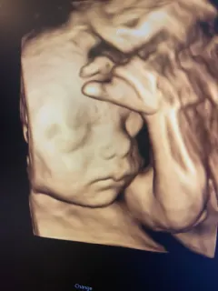 Op. Dr. Emine Suat profilinde yer alan galeri fotoğrafı.