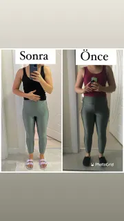 Dyt. Merve Sayın profilinde yer alan galeri fotoğrafı.
