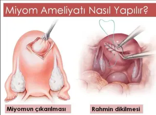 Op. Dr. Emine Eda Akalın profilinde yer alan galeri fotoğrafı.